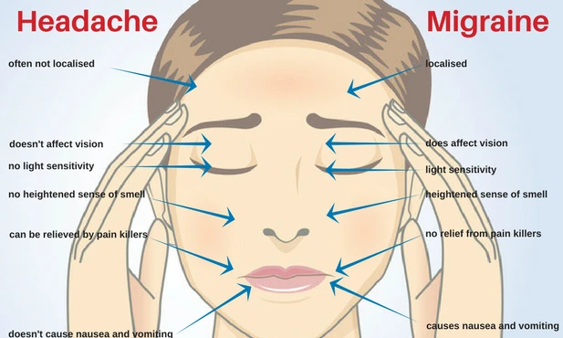 Illustration comparing headache and migraine symptoms on a face