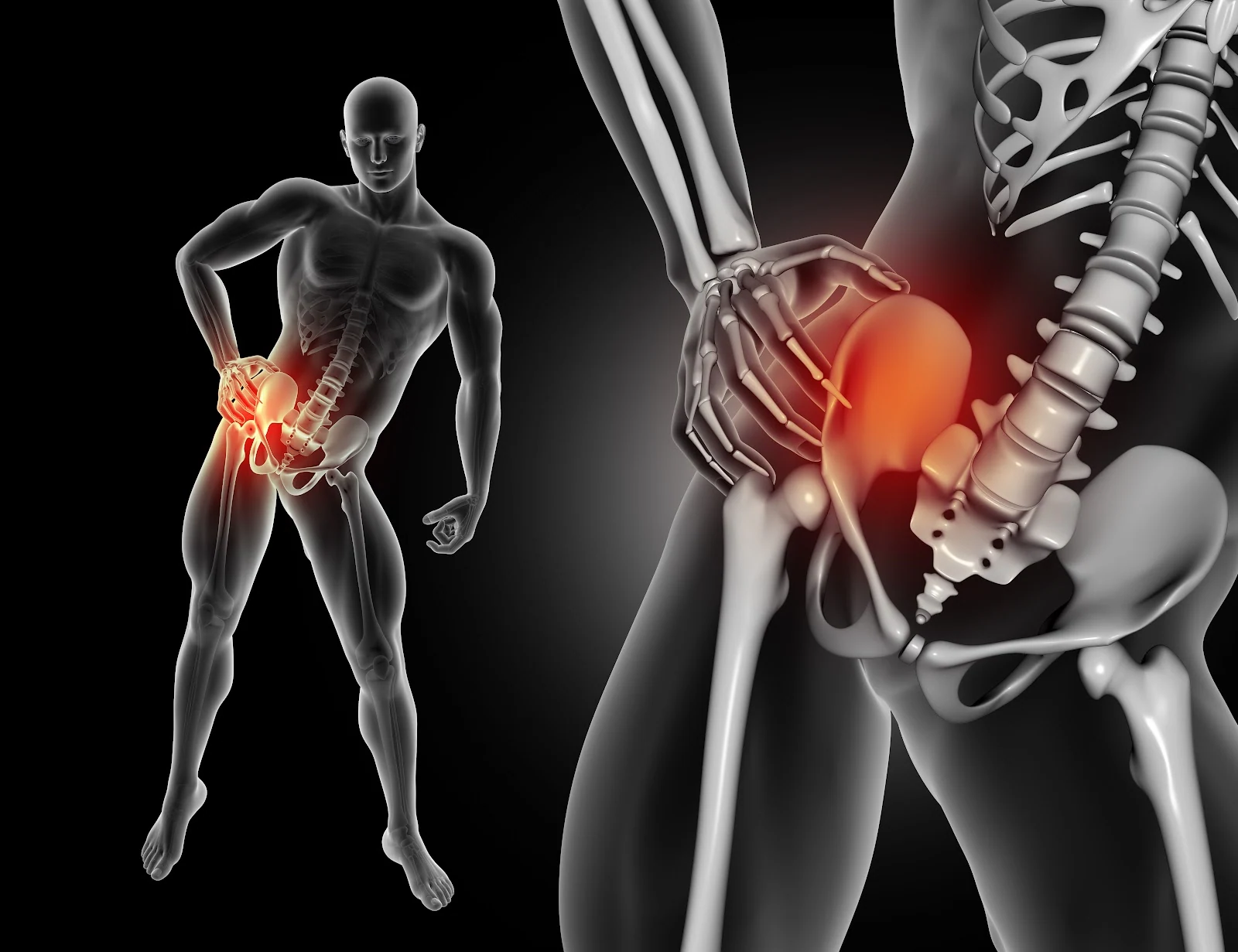 Illustration of a figure holding his hip with the painful joint highlighted