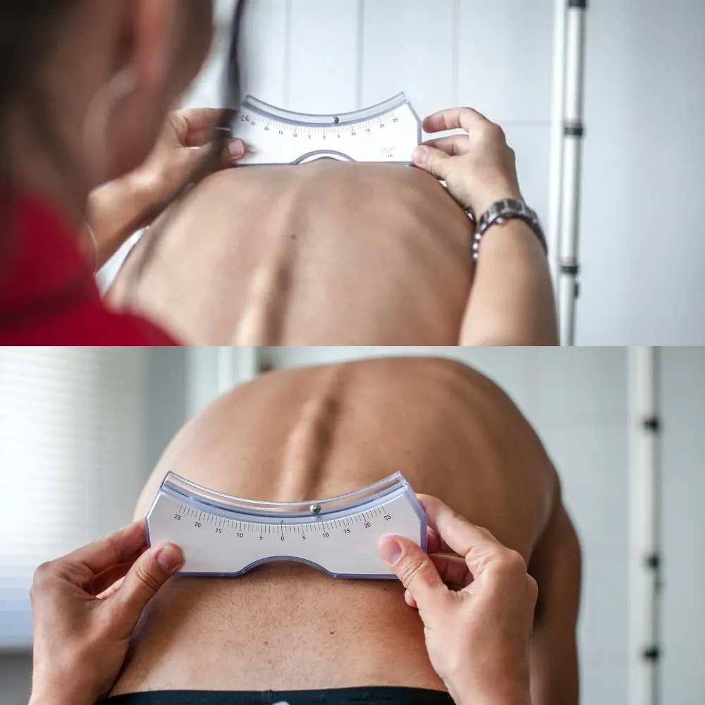 Two views of a scoliometer measuring a patient's back