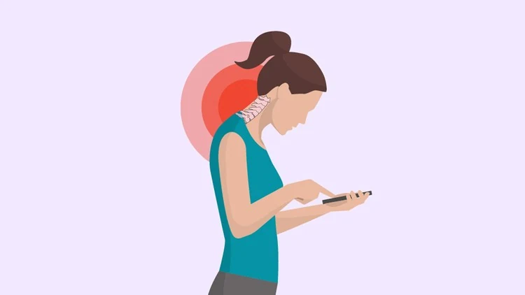 Text Neck