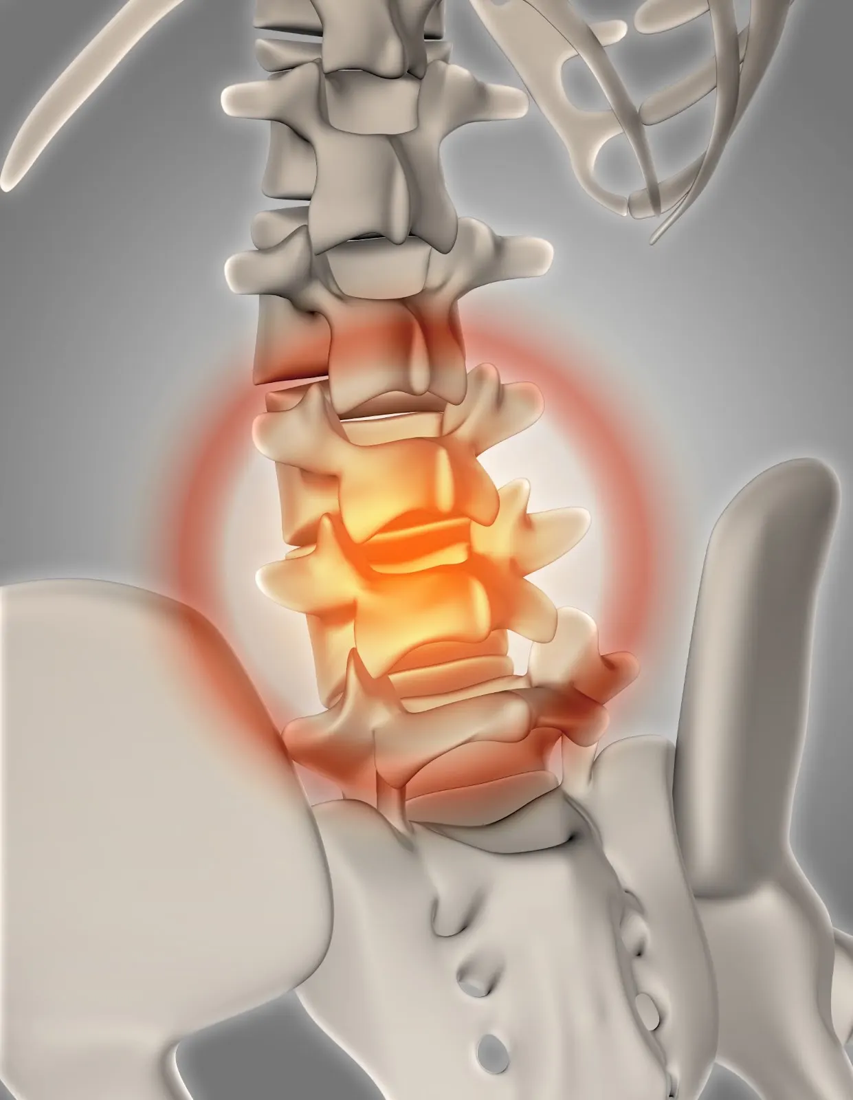What is a Bulging Disc?