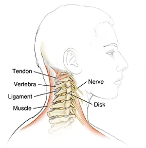 Whiplash in Children: Recognizing and Treating Injuries in Younger Individuals