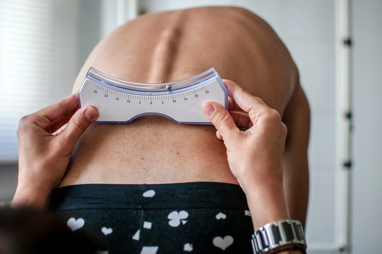 Scoliometer held across a patient's back to measure spinal curvature