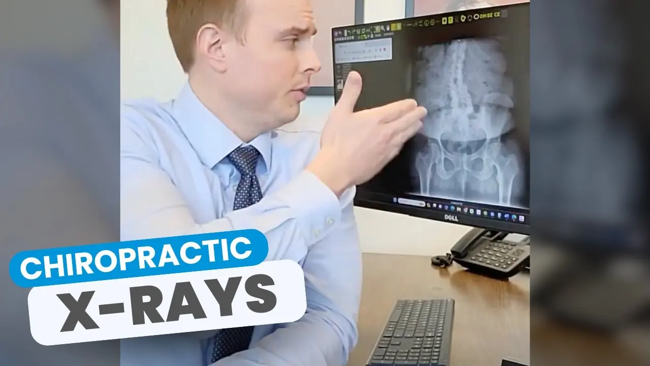 Getting an X-Ray of Your Spine