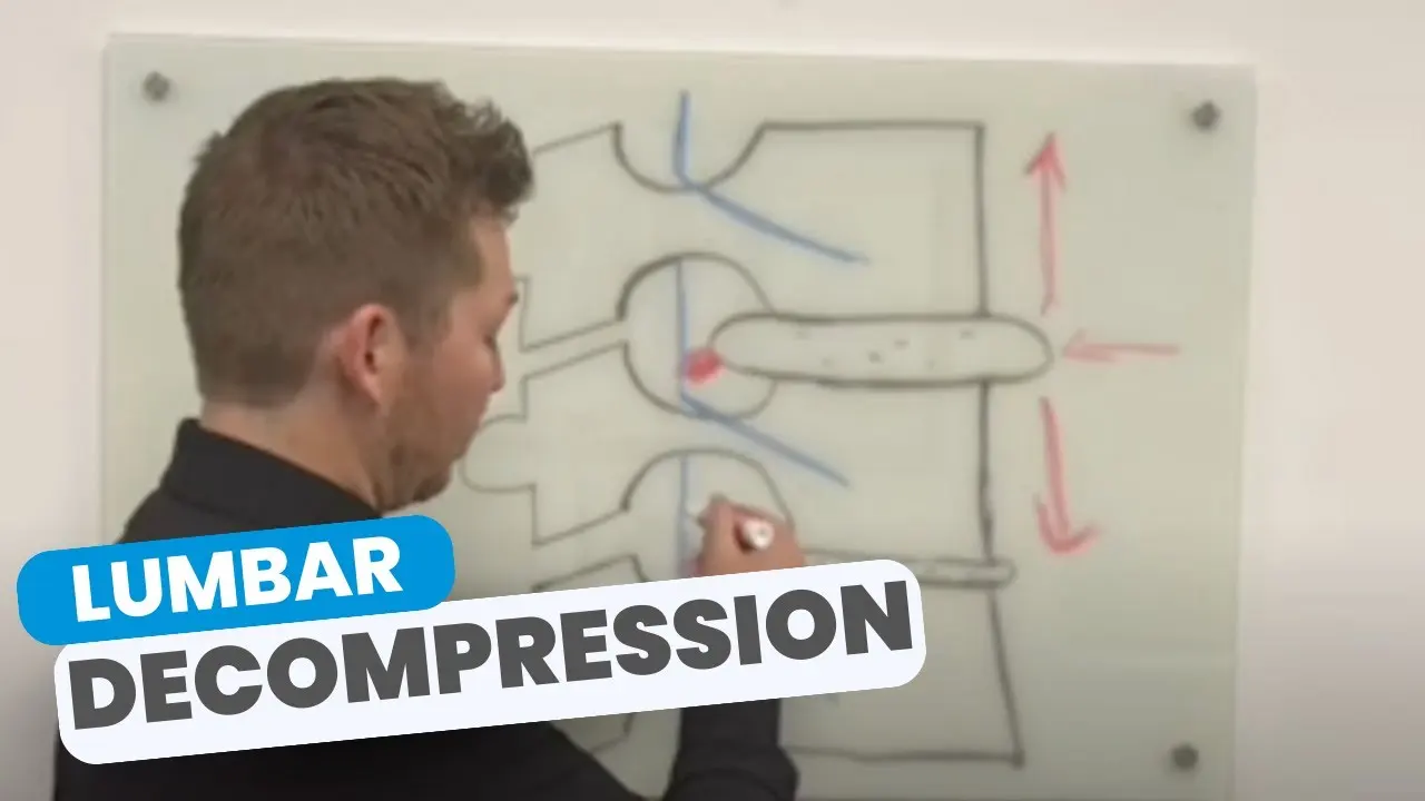 Spinal Decompression Therapy in West Fargo